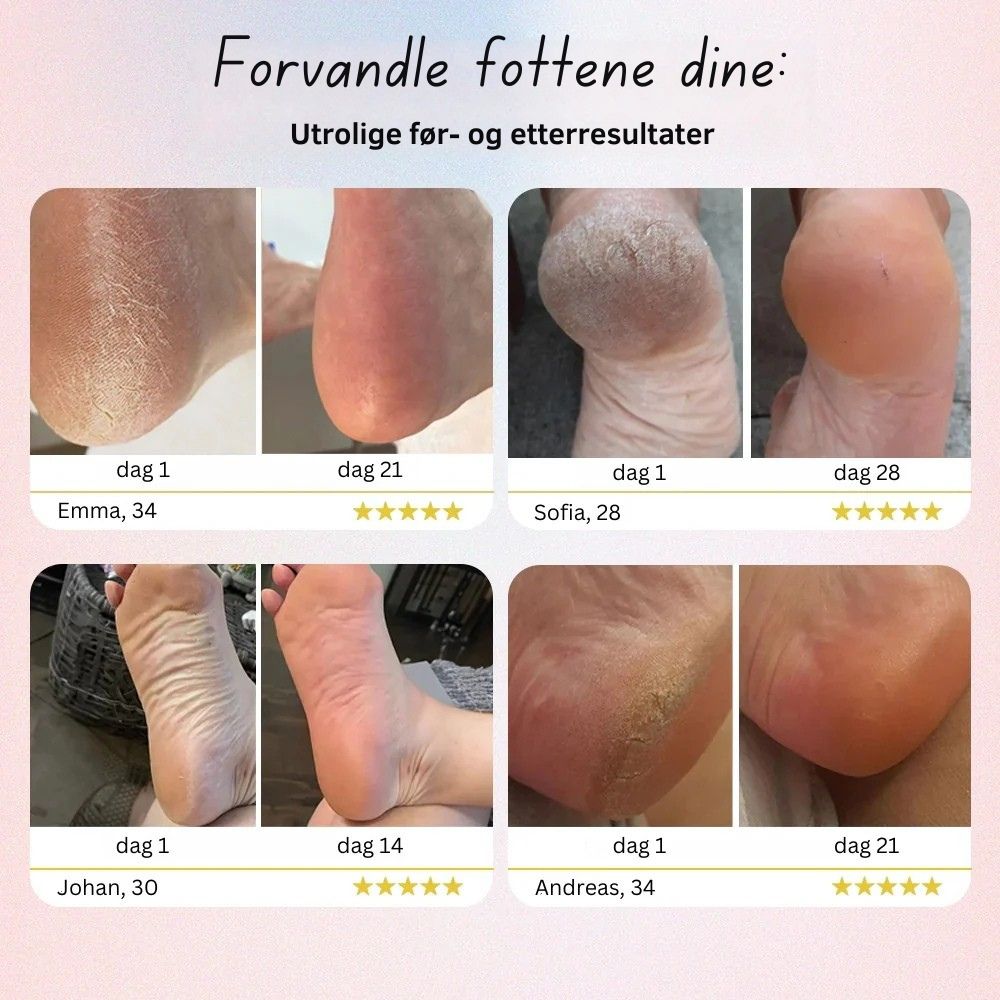 Elektrisk fotfil